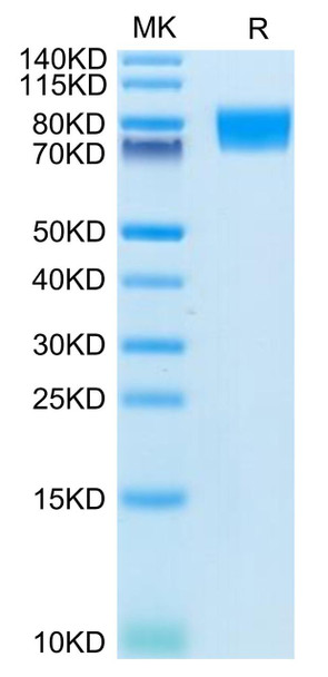 Recombinant Human c-Kit/CD117 Protein (RPCB0600)