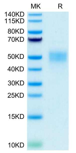 Recombinant Human Fc-gamma RIII beta/FCGR3B/CD16b Protein (RPCB0609)