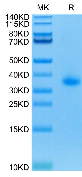 Recombinant Human TNFRSF5/CD40 Protein (RPCB0639) Recombinant Human TNFRSF5/CD40 Protein (RPCB0639)