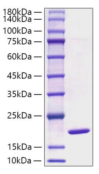 Recombinant Mouse Alpha-Synuclein/SNCA Protein (RPCB0666)