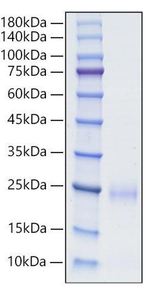 Recombinant Human BY55/CD160 Protein (RPCB0675)