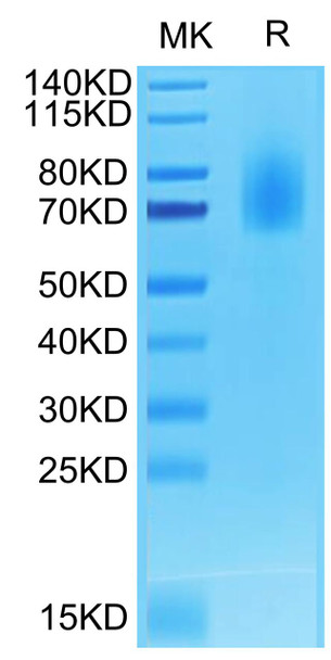 Biotinylated Recombinant Human TNFRSF8/CD30 Protein (RPCB0688)