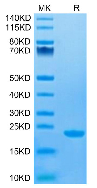 Recombinant Human MS4A1/CD20 Protein (RPCB0704)