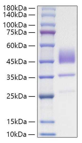 Recombinant Human Brain Natriuretic Peptide/NT-proBNP Protein (RPCB0709)