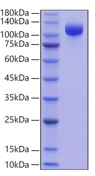 Recombinant Human Siglec-2/CD22 Protein (RPCB0711)