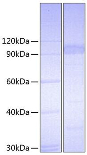 Recombinant Mouse IL-23R Protein (RPCB0713)