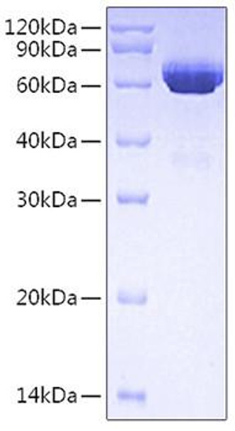 Recombinant Human Tissue-type plasminogen activator/TPA/PLAT Protein (RPCB0722)
