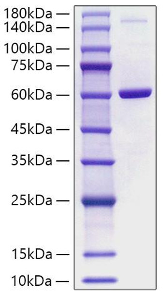 Recombinant Human PBEF/Visfatin/NAMPT Protein (RPCB0743) Recombinant Human PBEF/Visfatin/NAMPT Protein (RPCB0743)