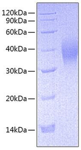 Recombinant Mouse Fc-gamma RIII/CD16 Protein (RPCB0744)