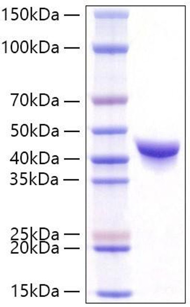 Recombinant Human DPEP1 Protein (RPCB0762) Recombinant Human DPEP1 Protein (RPCB0762)