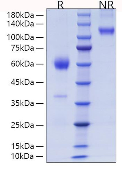 Recombinant Mouse Placenta growth factor/PlGF/PGF Protein (RPCB0771)