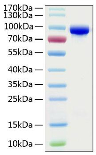 Recombinant Human Transferrin/TF Protein (RPCB0778)
