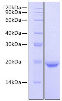 Recombinant Human IL-17F Protein (RPCB0789)