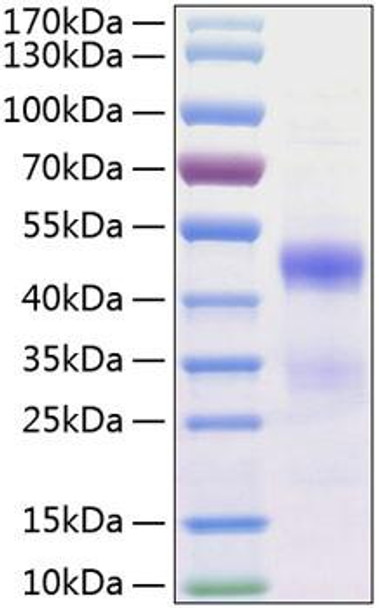Recombinant Human NovH/CCN3(N97K) Protein (RPCB0795)