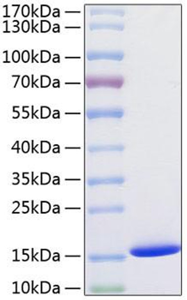 Recombinant Human Cystatin-SA/CST2 Protein (RPCB0803)