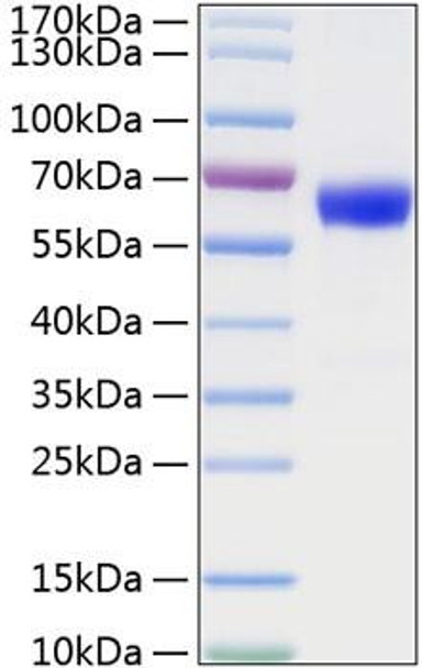 Recombinant Mouse TNFRSF1A/TNF-R1/CD120a Protein (RPCB0816)