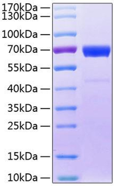 Recombinant Human IL-20RB Protein (RPCB0824)