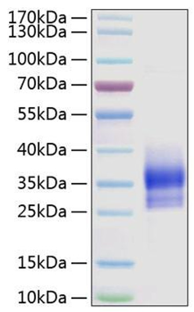 Recombinant Human Sclerostin/SOST Protein (RPCB0845)