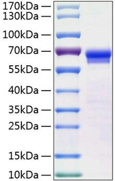 Recombinant Human JAM-B/VE-JAM/CD322 Protein (RPCB0847)