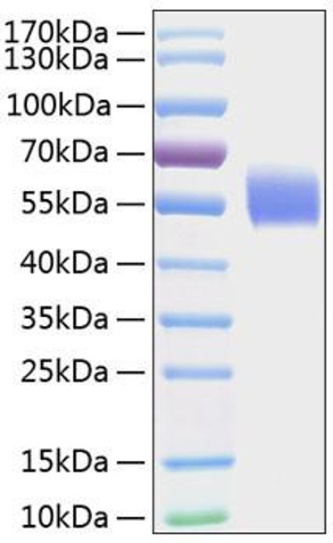 Recombinant Human IL-1R1/CD121a Protein (RPCB0850) Recombinant Human IL-1R1/CD121a Protein (RPCB0850)