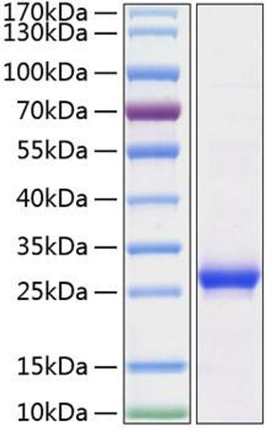 Recombinant Rat Lipocalin-2/NGAL/LCN2 Protein (RPCB0862)