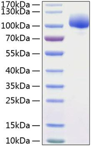 Recombinant Human FGFR-1/FLT-2/CD331 Protein (RPCB0871)
