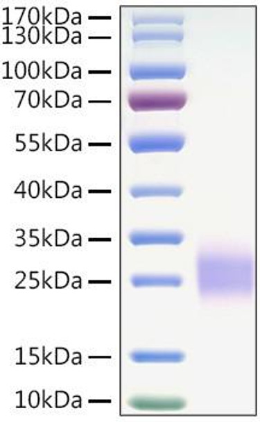 Recombinant Mouse CTLA-4/CD152 Protein (RPCB0894)
