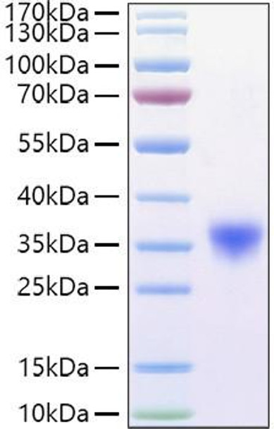 Recombinant Mouse Fc-gamma RIV/FCGR3A/CD16a Protein (RPCB0909)