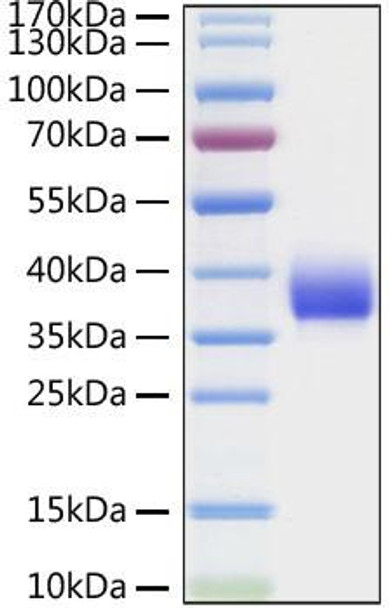 Recombinant SARS-CoV Spike RBD  Protein (RPCB0925)