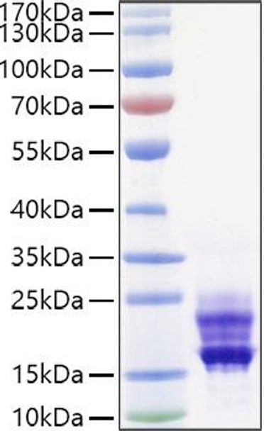 Recombinant Mouse IL-17A/CTLA-8 Protein (RPCB0932)