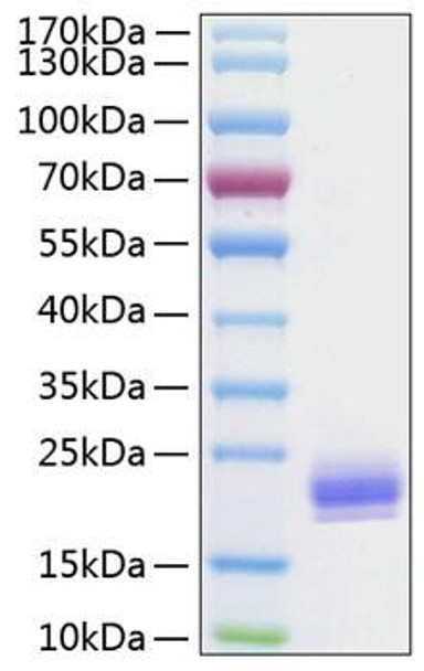 Recombinant Human LAIR-2/CD306 Protein (RPCB0938)