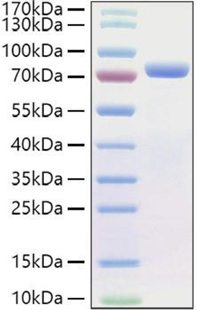 Recombinant Human E-Cadherin/CDH1/CD324 Protein (RPCB0944)