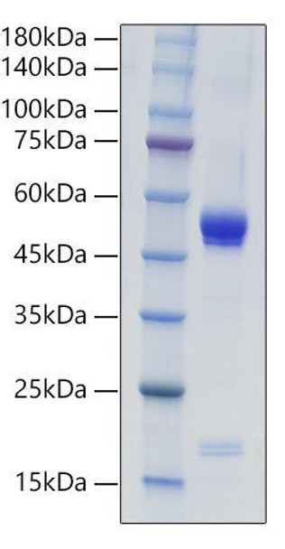 Recombinant Mouse IL-21 Protein (RPCB0956)