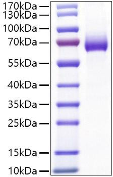 Recombinant Mouse IL-2RA/CD25 Protein (RPCB0968)