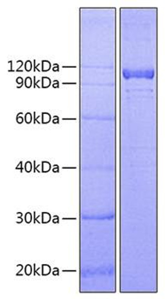 Recombinant Human IL-12 R beta 1/CD212 Protein (RPCB0972) Recombinant Human IL-12 R beta 1/CD212 Protein (RPCB0972)