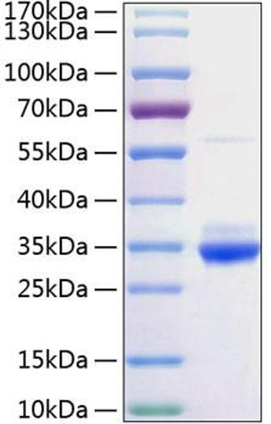 Recombinant Rat C-Reactive Protein/CRP Protein (RPCB0996)