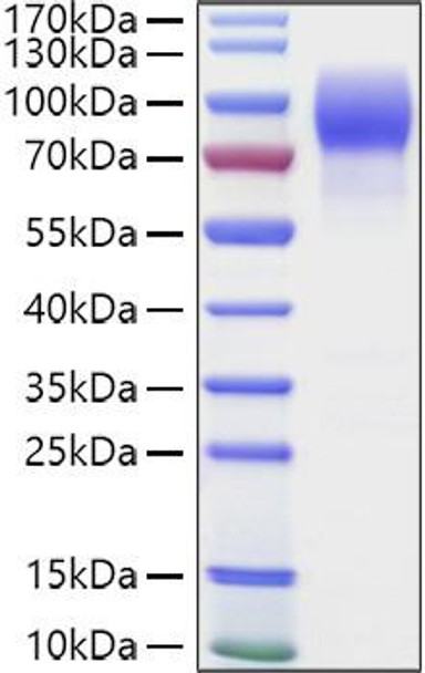 Recombinant Human MUC-16/CA125 Protein (RPCB1017) Recombinant Human MUC-16/CA125 Protein (RPCB1017)