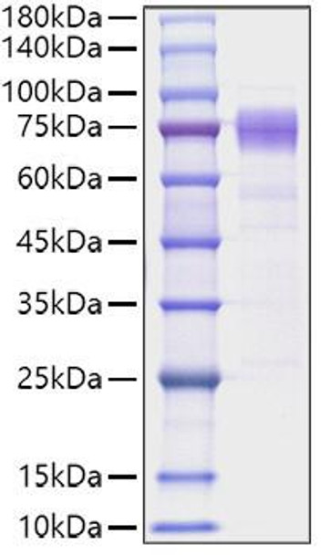 Recombinant Human IL-10RA/CD210 Protein (RPCB1027) Recombinant Human IL-10RA/CD210 Protein (RPCB1027)