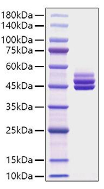 Recombinant Mouse IL-12B/IL-12 p40 Protein (RPCB1028) Recombinant Mouse IL-12B/IL-12 p40 Protein (RPCB1028)