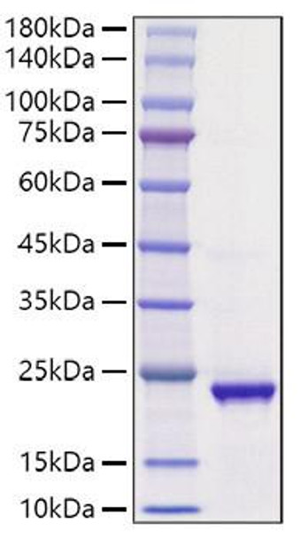 Recombinant Human IHH Protein (RPCB1034)