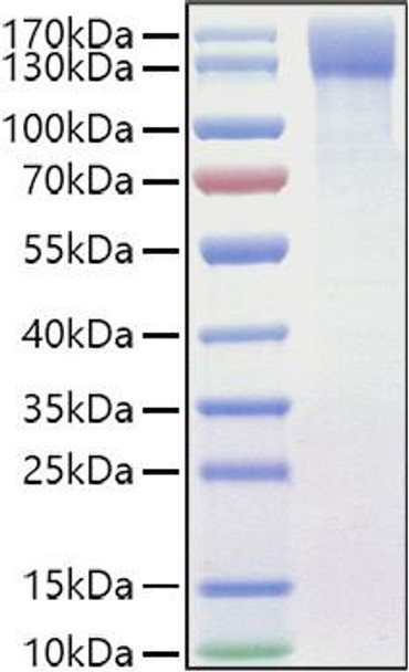 Recombinant Mouse OSMR/IL-31RB Protein (RPCB1042)