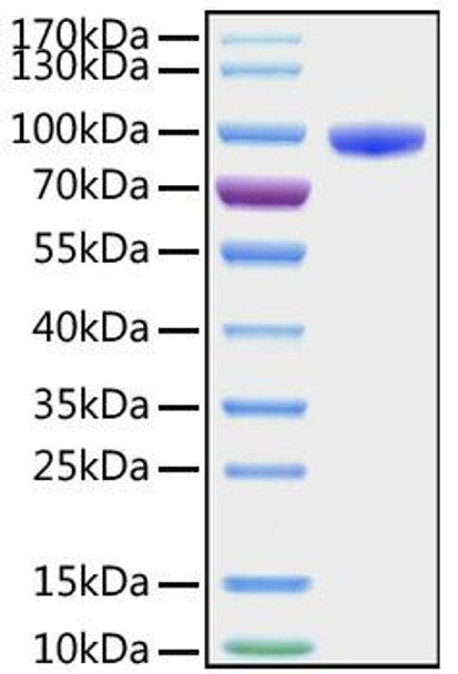 Recombinant Human CD177 Protein (RPCB1054)