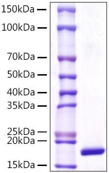 Recombinant Human Lipocalin-1/LCN1 Protein (RPCB1062)