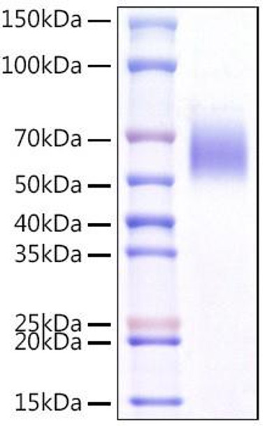 Recombinant Mouse IL1RL1/ST2 Protein (RPCB1063)