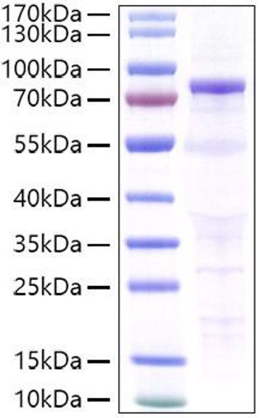 Recombinant Human CDH3/P-cadherin Protein (RPCB1064)