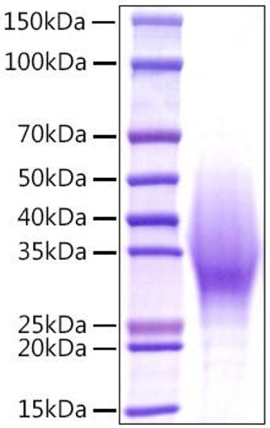 Recombinant Mouse IL-18BP Protein (RPCB1067)