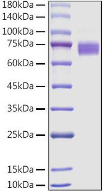 Recombinant Mouse Fc-epsilon RI-alpha/FCER1A Protein (RPCB1069)