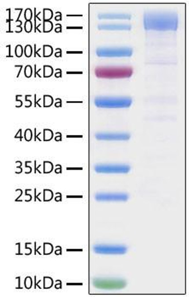 Recombinant SARS-CoV-2 Spike S1 Protein (RPCB1081)
