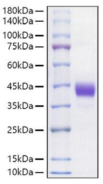Recombinant Mouse CD52 Protein (RPCB1089)