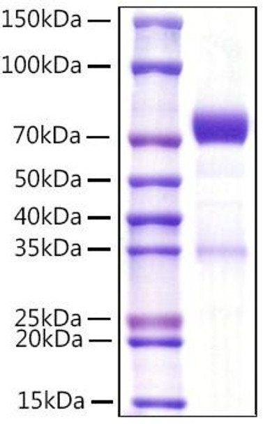 Recombinant Mouse NKp46/NCR1/CD335 Protein (RPCB1096)